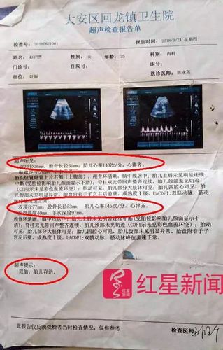 医院回应女童铊中毒