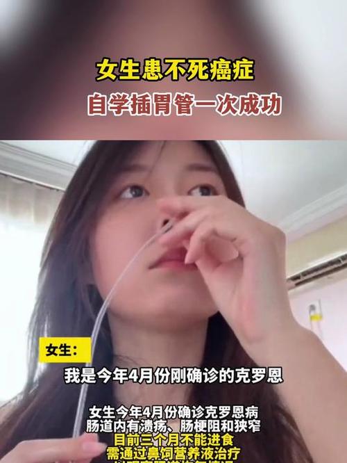 九点半9点半澳彩资料和00后女孩自学插胃管与00后女孩自学插胃管视频